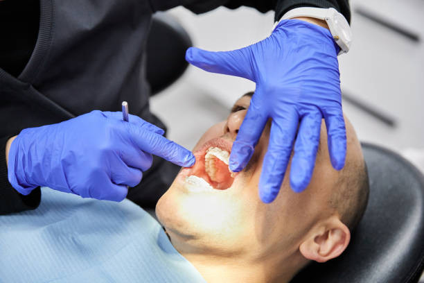 Best Emergency Wisdom Tooth Extraction in Schofield Barracks, HI